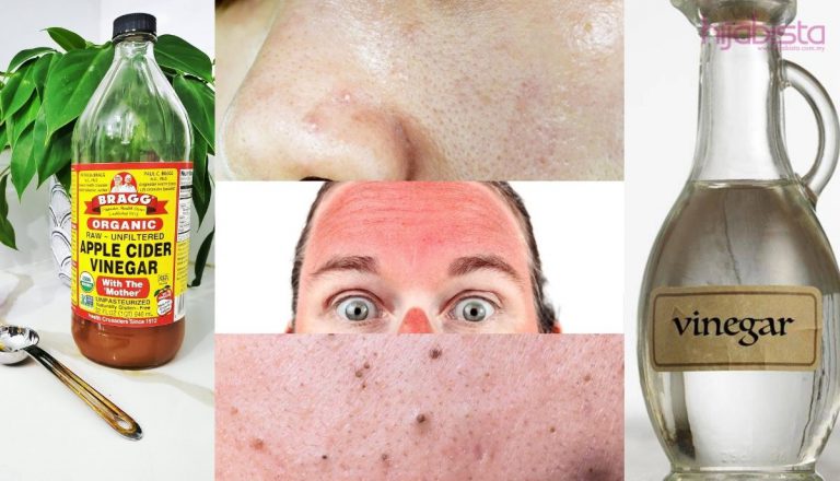 Cuka Sari Epal Mampu Memperbaiki Masalah Kulit Wajah Dan Badan Dengan 15 Kaedah Ini