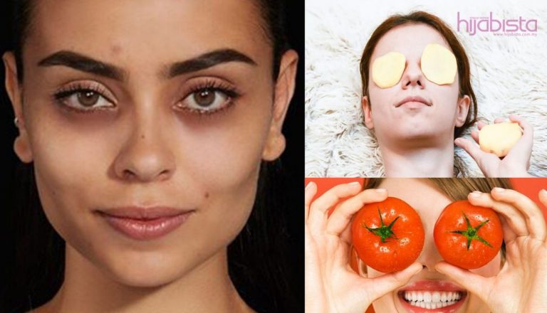 Hilangkan Kesan Hitam Bawah Mata Dengan Cepat, Amalkan Petua Ini Hanya Dengan Bahan Semula Jadi Sahaja!