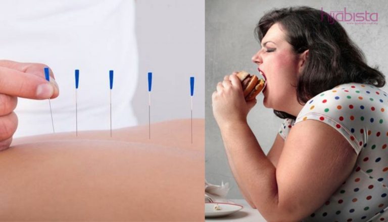 Obesiti Punca Ketidaksuburan, Rawat Dengan Kaedah Akupuntur & Tradisional!