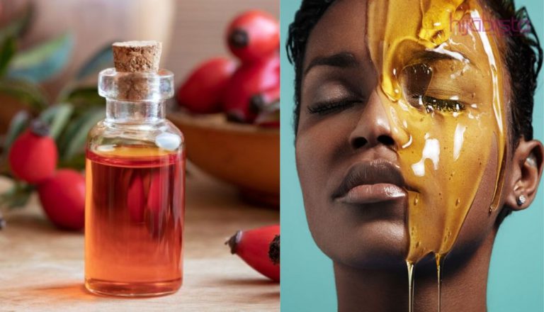 Kehebatan Minyak Roseship Mengatasi 9 Masalah Kulit Malah Mampu Menyuburkannya