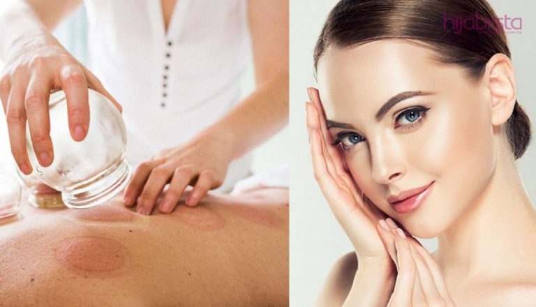 Kembalikan Keserian Wajah Dengan Rawatan Bekam Darah & Angin! Pasti Tampak Muda & Sihat Sentiasa!