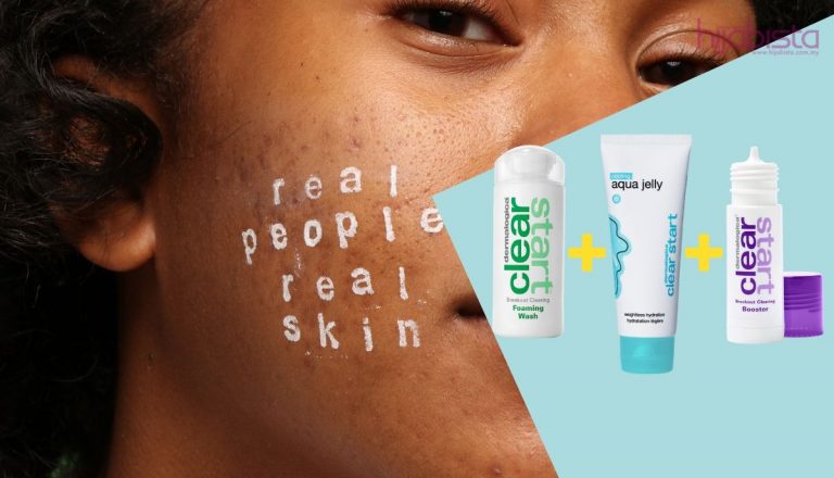 4 Langkah Mudah Rawat Jerawat, Hanya Perlu 3 Produk Dalam Rutin Penjagaan Kulit Anda