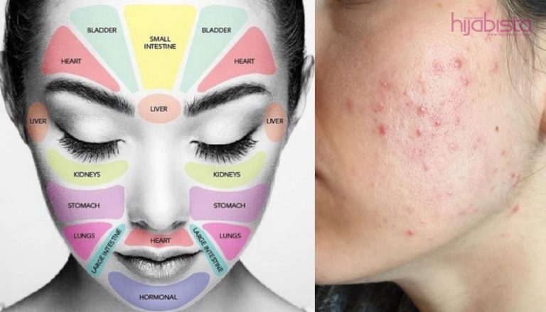 Rawat Kulit Bermasalah, Fahami Dahulu Pemetaan Muka Anda. Barulah Kulit Cantik & Sihat!