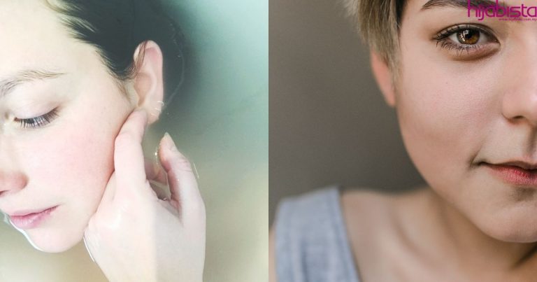 Ikut Cara Mudah Ini Bagi Merawat Kulit Yang Jadi Merah & Mengelupas Akibat Sunburn