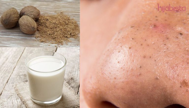 Blackhead Pada Hidung & Pipi, Lenyapkan Hanya Guna Campuran Buah Pala & Susu