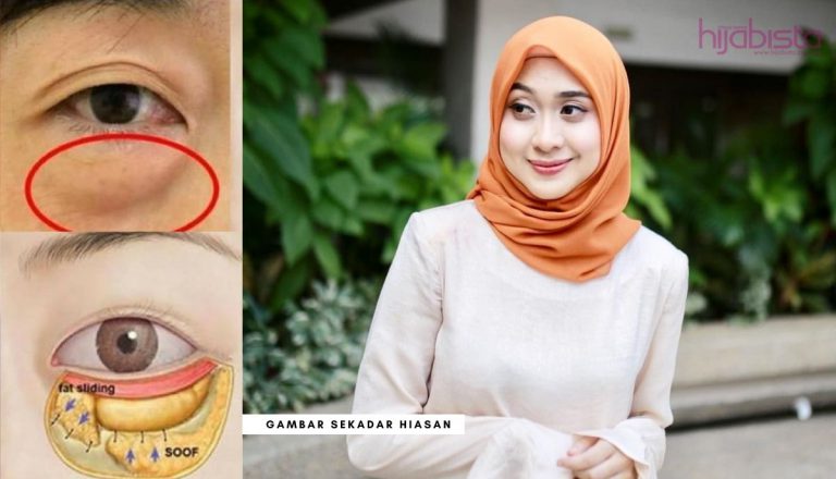 10 Cara Atasi Masalah Kantong Mata Atau Eye Bag Tanpa Solekan Tebal.