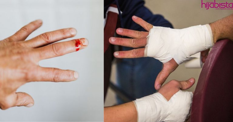 Jangan Panik, Ini Yang Perlu Anda Lakukan Bagi Selamatkan Anggota Badan Yang Terputus