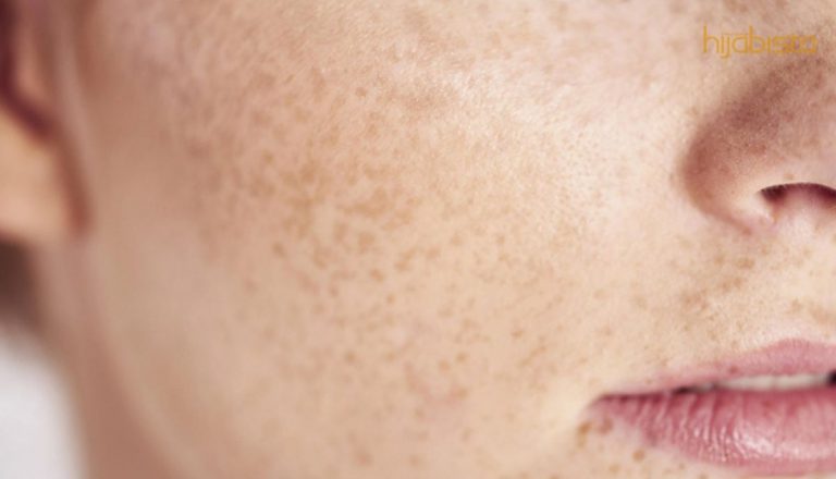 Serum Ini Mampu Selesaikan Masalah Bintik-bintik Hitam Dan Kulit Wajah Yang Kusam