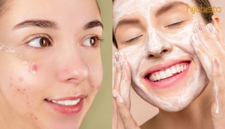 Susahnya Nak Hilangkan Jerawat! Cuba 5 Pilihan Gel Yang Efektif, Murah & Senang Cari!