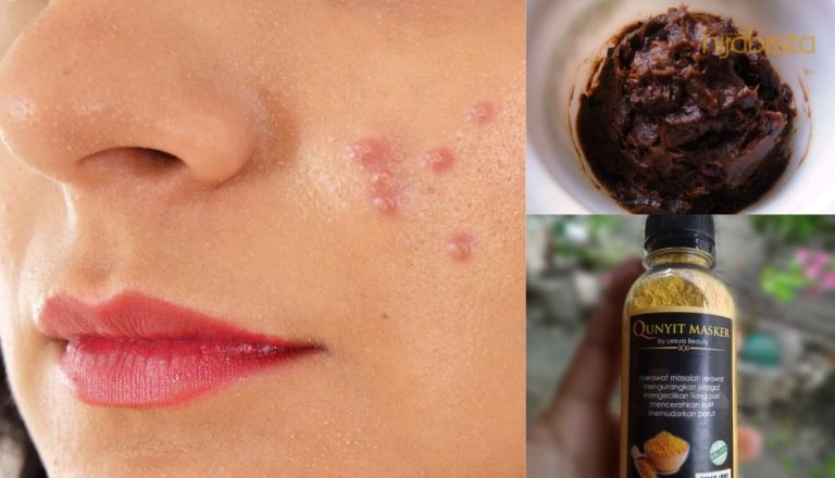 Cara Rawat Jeragat & Jerawat Sebelum Melarat, Tak Perlu Nak ‘Cover’ Dengan Mekap Pun