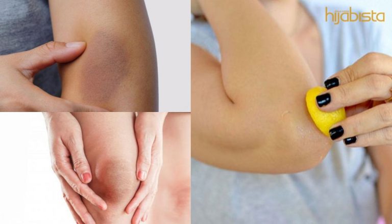 Rupanya Kawasan Lutut Dan Siku Gelap Macam Berdaki Boleh Hilang Dengan Guna Bahan Di Rumah Jer!