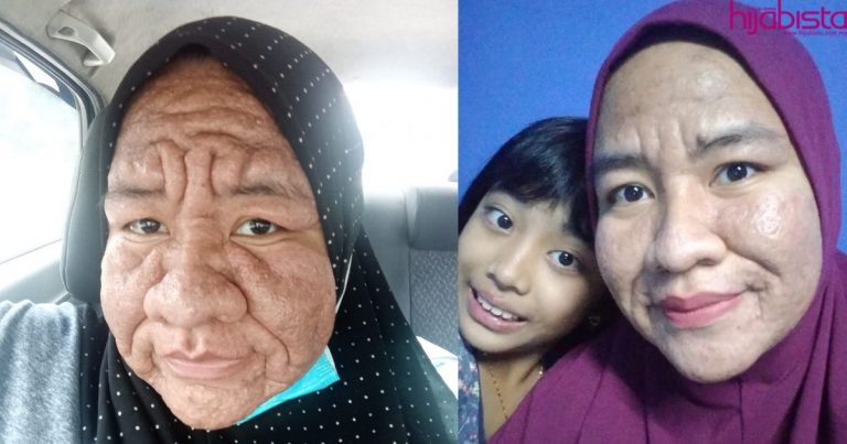 Wajah Berubah Sewaktu Hamil, Wanita Bersyukur Suami Tak Jemu Beri Sokongan & Pujian