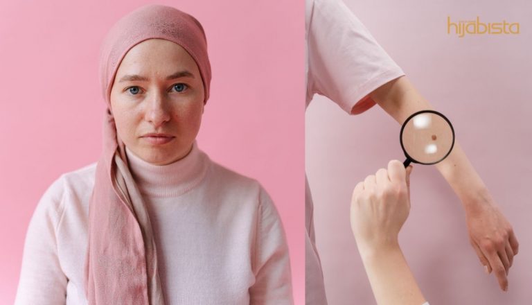 Penjagaan Kulit Ketika Anda Menjalani Rawatan Barah, Ikuti 4 Petua Terbaik Ini Dari Pakar