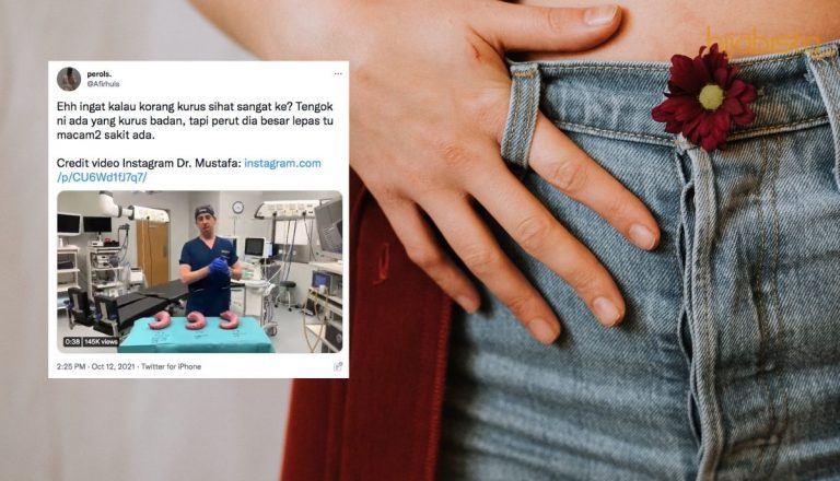 Jangan Bangga Sangat Badan Kurus, “Badan Kecil Tapi Perut Besar Malah Banyak Penyakit”. Awas Ya!