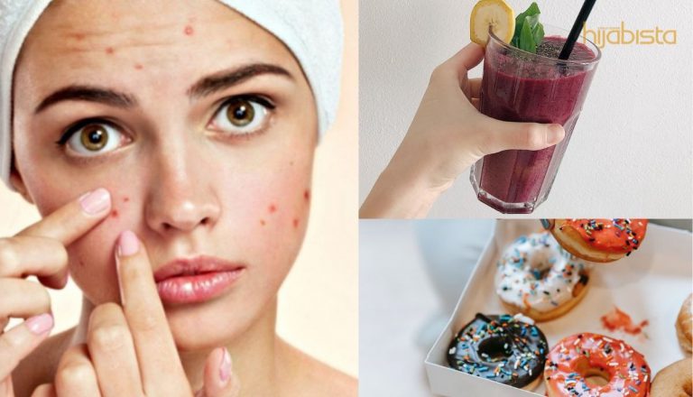 Alamak! Rupanya 5 Pilihan Makanan Ini Menjadikan Wajah Kelihatan Kusam Dan Tidak Berseri!