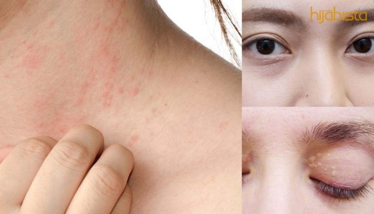 9 Tanda Pada Wajah Dan Badan Yang Jelas Boleh Menjadi Petunjuk Anda Sakit