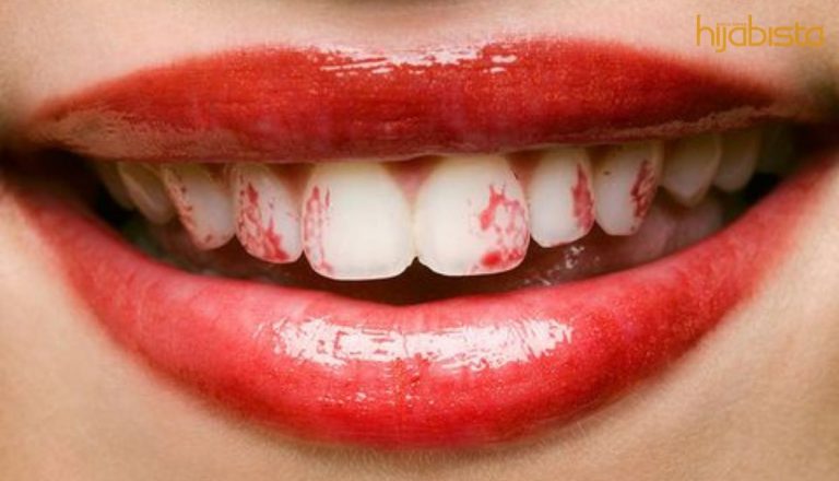 Lipstik Melekat Pada Gigi Sangat Memalukan! Atasinya Dengan 5 Tip Mudah Ini!