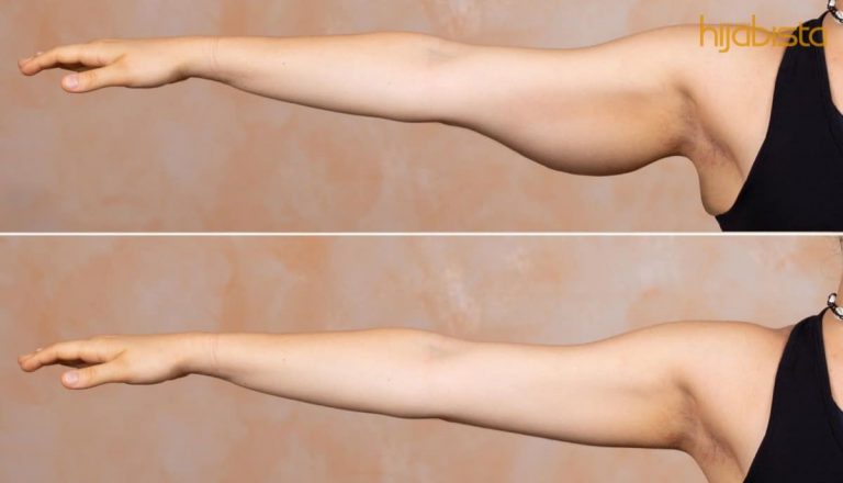 Lengan Besar Mengalahkan Paha? Kecilkannya Dengan 12 Senaman Mudah Ini!