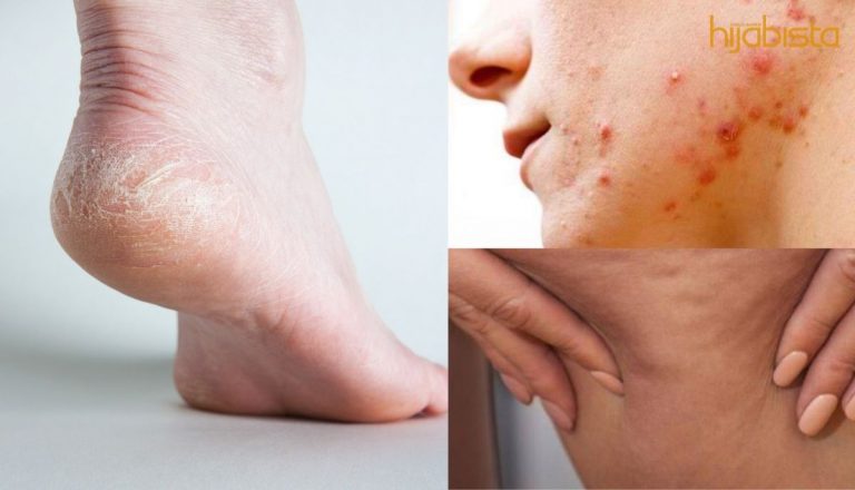 7 Minyak Ajaib Dari Bahan Semula Jadi Ini Bantu Selesaikan Masalah Kulit Dengan Pantas.