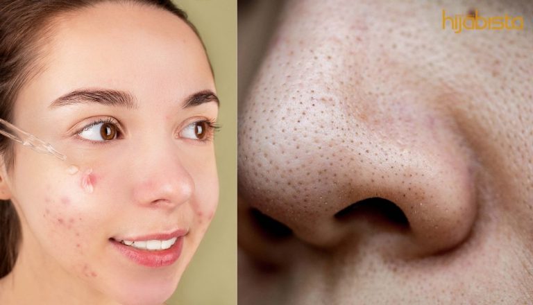 Kawal Minyak Muka Tanpa Menyumbat Pori-Pori, Squalane Bahan Yang Diiktiraf Pakar.