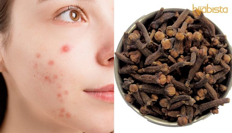 Bunga Cengkih Boleh Atasi Masalah Jerawat Dengan Berkesan! Ini 5 Kebaikan Bunga Cengkih Yang Wajib Anda Tahu!