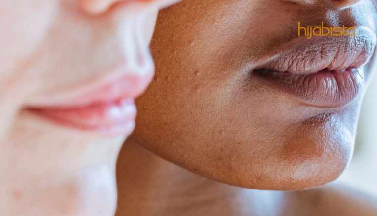 Umur 20 Dah Ada Jerawat? Kamu Tidak Keseorangan! Inilah Cara Menangani Jerawat Dewasa…