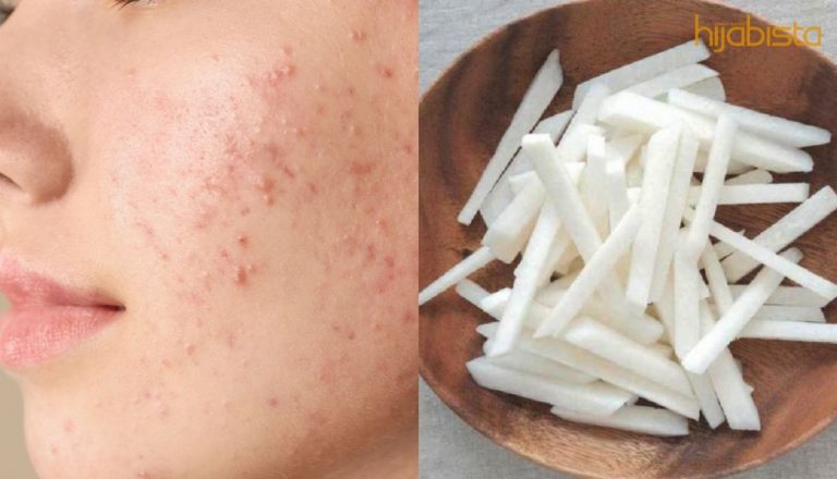 Ingin Cepat Hilangkan Jerawat, Jadikan Sengkuang Sebagai Menu Utama Anda! Ini 5 Sebab Yang Anda Harus Tahu!