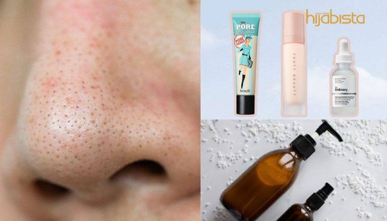 Masalah Liang Pori-Pori Besar Buat Anda Jadi Malu, Atasinya Dengan 6 Solusi Mudah Ini!