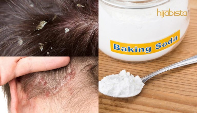 Pelbagai Jenis Kelemumur Dan Cara Menghentikannya Tanpa Membazirkan Wang