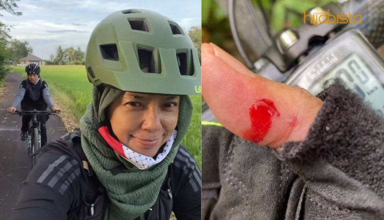 Jatuh Dan Berdarah Nak Elak Ular, Puan Sri Normala Samsudin Berjaya Berbasikal Sejauh 36.75 Km! Hebatnya!