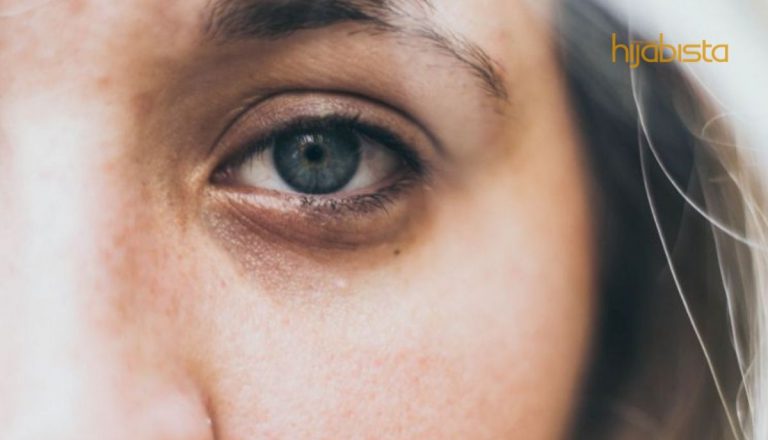 5 Petua Ini Boleh Bantu Hilangkan Lingkaran Gelap Bawah Mata. Barulah Mata Tak Macam Panda!