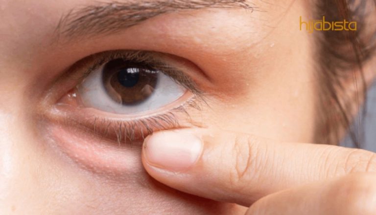 Ais Batu Dan Nasi Panas Mampu Hilangkan Bengkak Mata. Semak Empat Lagi Cara Lain Jimat Kos