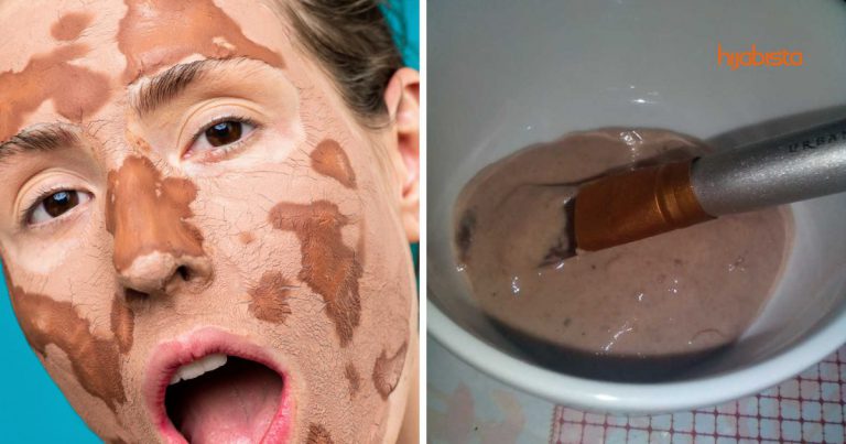 Parut Jerawat Hilang Dengan Masker Bancuhan Tepung Pulut/Beras + Asam Jawa, Kulit Pun Jadi Lembut Je