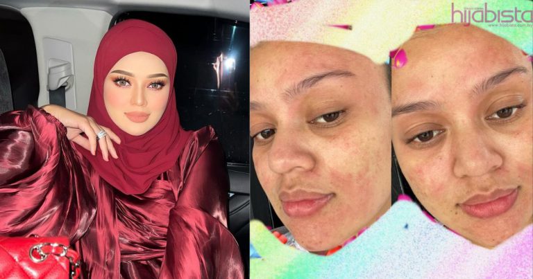 “Naik Miang Tu Allah Aii…” – Mua Bellaz Alami Alahan Bila Makin Dekat Nak Bersalin