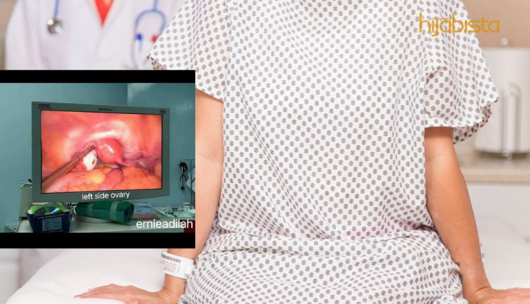 Banyak Makan Process Food & Junk Food, Setahun Sekali Period..Baca Pengalamannya Apabila Ovari Dipenuhi Cyst!