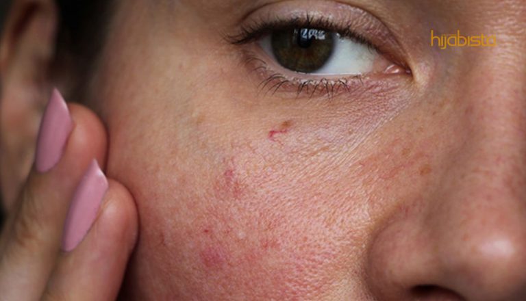 Allantoin Ramuan Produk Kecantikan K-Beauty Yang Unggul Untuk Tenangkan Kulit Sensitif