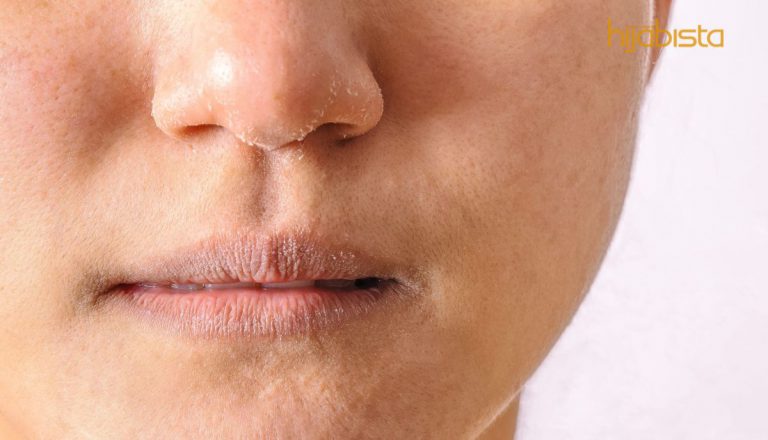 Pakai Mekap Tidak Merengsakan, Aplikasi Di Muka Tidak Kemerahan, Ini Cara Pilih Produk Mesra Ekzema