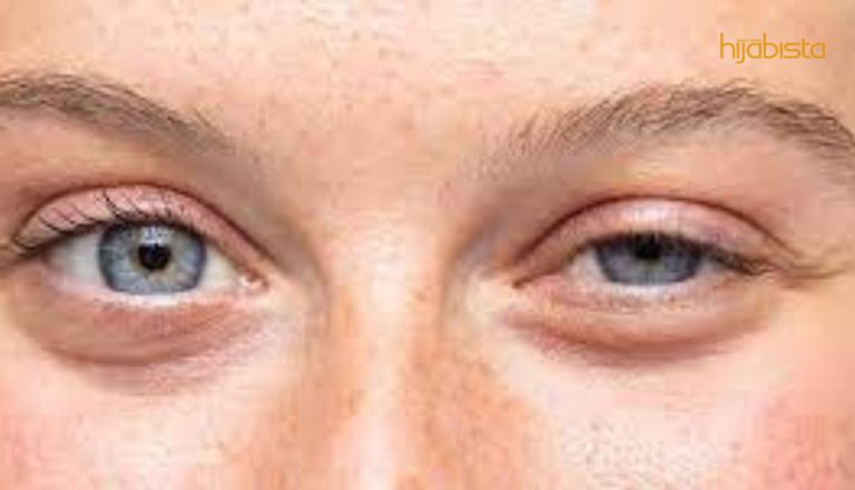 Jangan Pandang Remeh Bila Mata Sepet Sebelah!