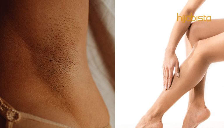 Dah Cukur, Tapi Ada Rambut Tumbuh Di Dalam, Pakar Cadang Ada Teknik Yang Betul. Licin Terus!