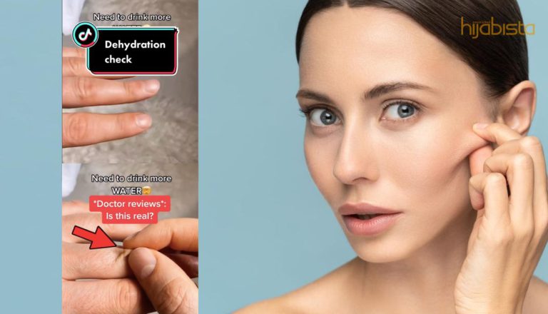 Ujian Cubit Kulit LIhat Sama Ada Anda Mengalami Dehidrasi. 3 Saat Sahaja!