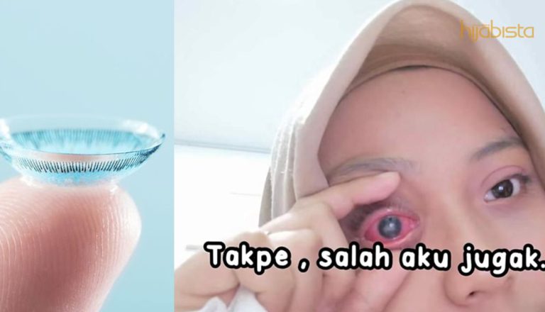 ‘Sudah Jatuh, Ditimpa Tangga’, Gadis Ini Kongsi Pengalaman Hampir Cacat Disebabkan Kanta Lekap.