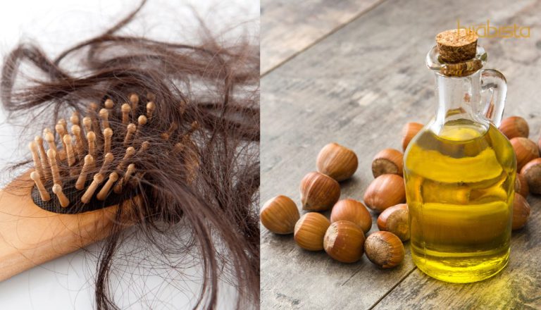 Kulit Kepala Punyai Masalah Psoriasis, Gunakan Minyak Kemiri Untuk Merawat Dan Melebatkan Rambut