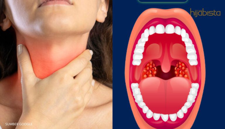 Jangan Ambil Remeh Dengan Tonsilitis Kerana Sangat Perit! Ini 4 punca mengapa ia terjadi