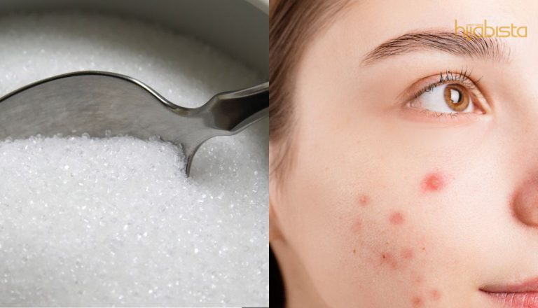 Gula Putih Punca Jerawat Teruk Dan Banyak Beri Kesan Buruk Pada Badan!