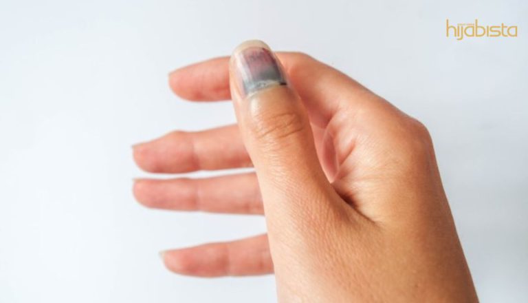 Kuku Hitam Petanda Anda Ada Masalah Kesihatan Teruk. Betul Ke?