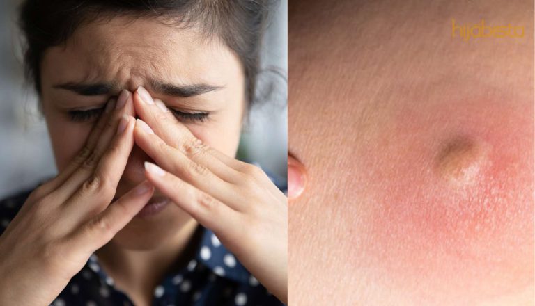 Benarkah Bisul Di Punggung Disebabkan Habit Duduk Atas Bantal?