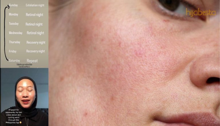 Trend Kecantikan ‘Kitaran Kulit’, 4 Minggu Tempoh Untuk Pulihkan Kulit Kusam Dan Jerawat Kembali Berseri.