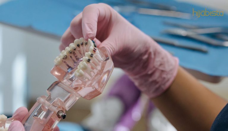 Gigi Nampak Kotor Kerana Pemilihan Warna Braces Yang Salah, Ikuti Tip Ini!