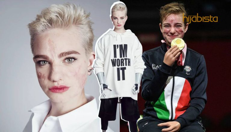 Juara Paralimpik Beatrice Vio Menjadi Wajah Baharu L’Oréal, Tampilkan Kecantikan Dan Keunikann Dirinya