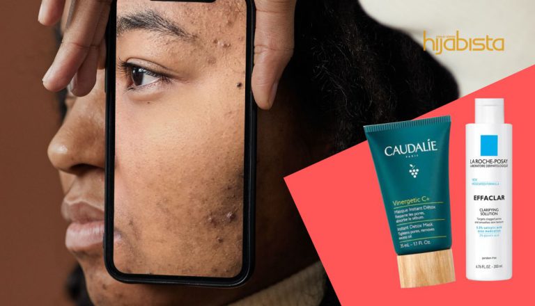 Masalah Jerawat Tumbuh Di Pipi, Ada Punca Yang Anda Tak Perasan